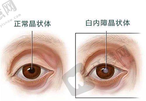 北京熙仁眼科医院交通路线