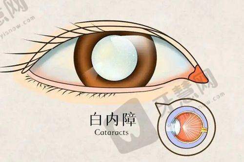 北京怀柔爱尔眼科医院与集团的关系优势