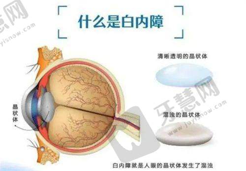 北京羽视眼科诊所丰富的诊疗项目