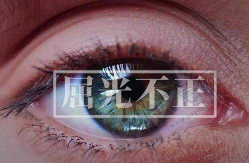 2025昆明胡敏眼科医生白内障类项目收费怎样？