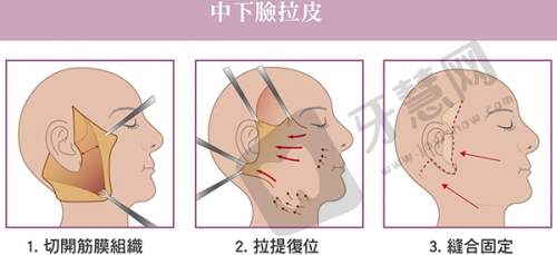 3. 深圳皮肤科好点的医院特色服务