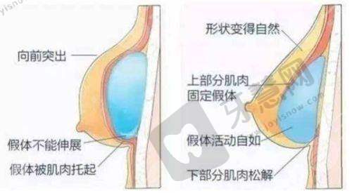 除皱针的危害和副作用之成效及其他问题