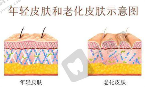 祛斑淡斑在线询问:2025年淡斑“隐藏神器”,这3个项目别忽略