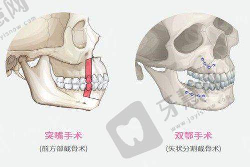 北京美雅枫医院张立彬馒化修复范例刷屏，亲测技术优价格低，满意度超98%！