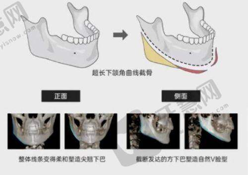 南京蓝鲟口腔医院怎么样——特色项目优势