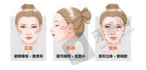合肥隆胸哪家医院做的比较好之合肥斯尔美整形