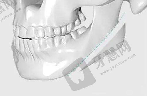 南京牙管家口腔医生介绍有亮点，邱涛/董婷婷技术优收费合理口碑好