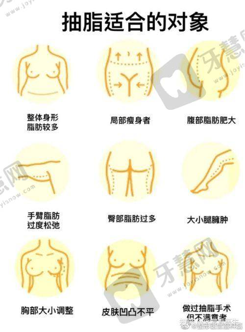 深圳哪家医院做完紧缩术好