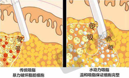 2025年全新价格参考:你的预算够吗?