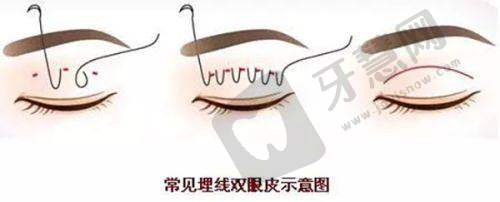 误区3：“在线询问后就能自己买药/做治疗”