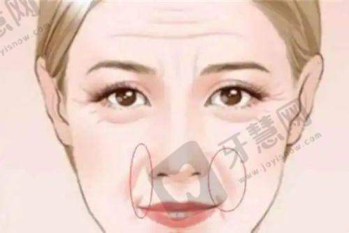 srt100浅放哪个医院有?其他地区医院特色