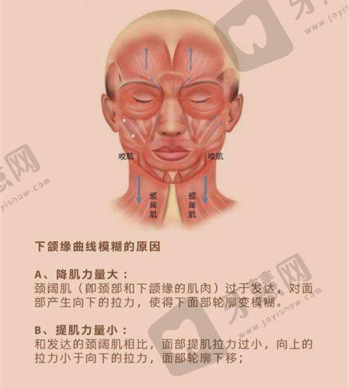 蹇洪医生小切口口内提升技术稳准的实例