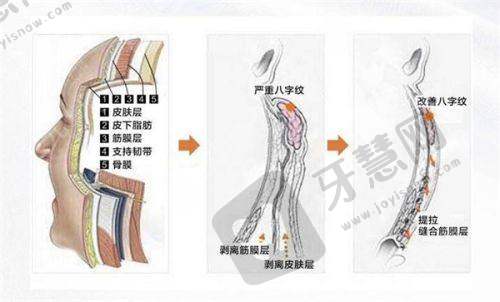 南京华韩奇致美容医院地铁路线之具体规划