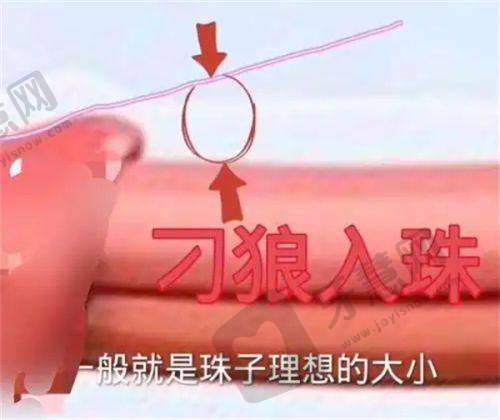 注射胶原蛋白后有硬块咋回事