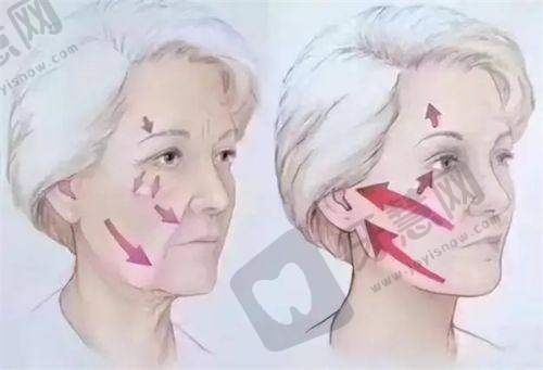 理性提醒:变得更美没有“捷径”,但有“聪明路”