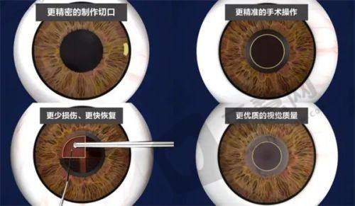 北京希玛眼科医院齐颖怎么样？我亲测她做屈光矫正超棒，收费合理服务还好！