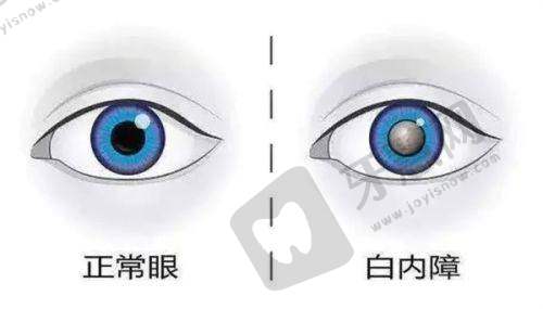 大连普兰店爱尔眼科医院眼底病手术的设备情况