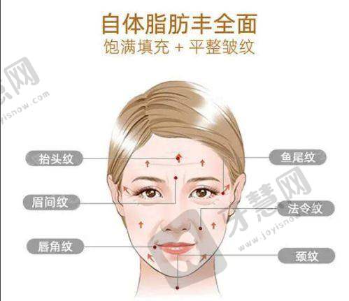李自力做正颌技术腻害——个性化治疗方案