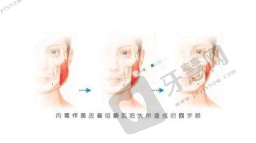 北京联合丽格第一和第二适合人群区别分析