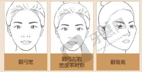 欧欧球面自锁托槽价格在2w左右,obrace是国产的优质牙套小贵之选择建议