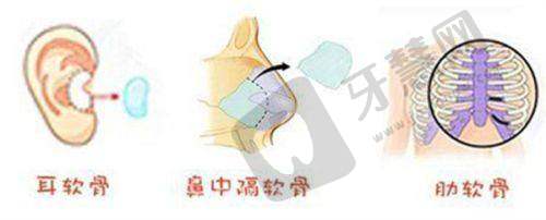 合肥隆胸医生排名之朱德刚