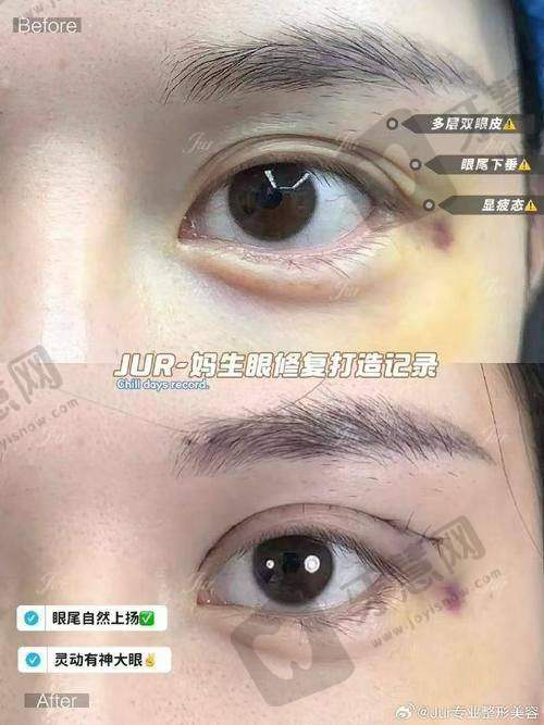 杨宇梓医生擅长的医疗美容项目