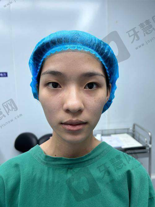 眼修复线上面诊200元后,这些“坑”千万别踩!