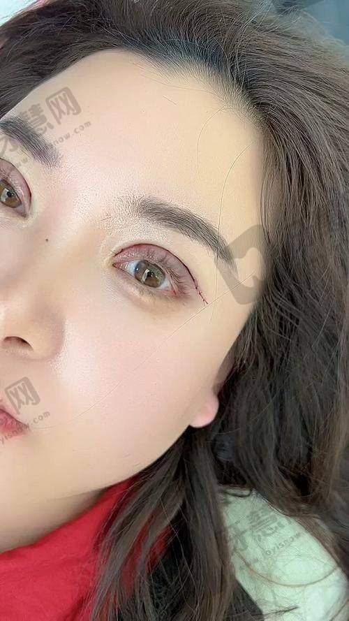 李泽松医生的坐诊医院：哈尔滨羽禅医疗美容门诊部