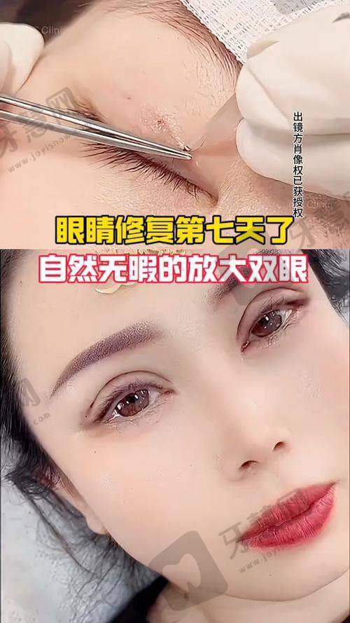眼修复线上面诊200元？先搞懂这3类医生才不白花钱！