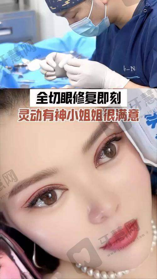 眼修复线上面诊200元？2025年眼部修复医生线上预约攻略大公开