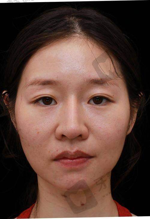 方芳医生擅长的医美项目