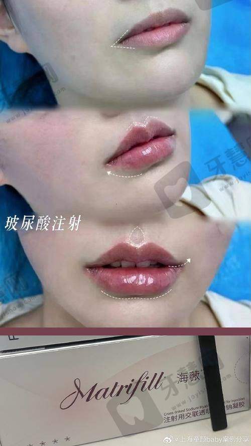 理性提醒:医美没有