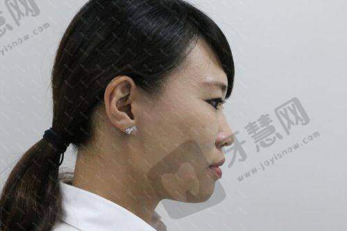 理性提醒：医美没有
