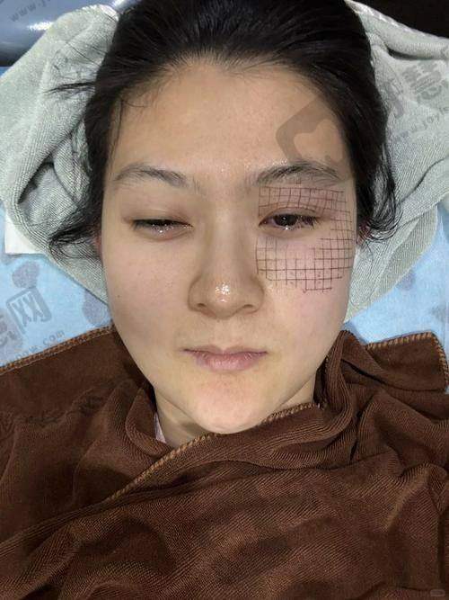 理性提醒：医美没有“万能医院”，适合自己才是更好