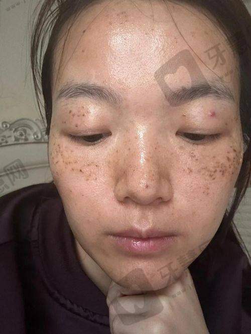 皮肤科在线询问免费24小时之宝宝专属通道：0-6岁婴幼儿为啥要单独设入口？