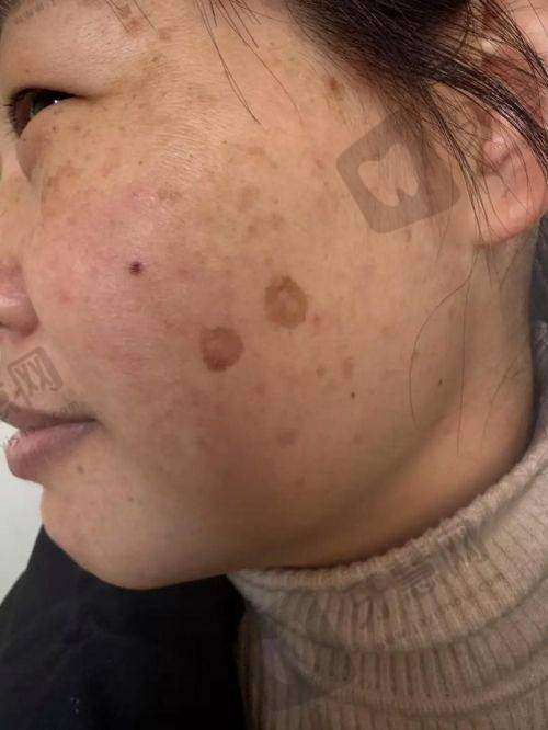 皮肤科在线咨询免费24小时！2025最新十大皮肤科医院1对1问诊攻略+宝宝专属通道
