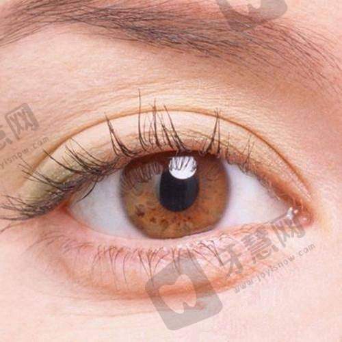 北京熙仁眼科医院挂号方式