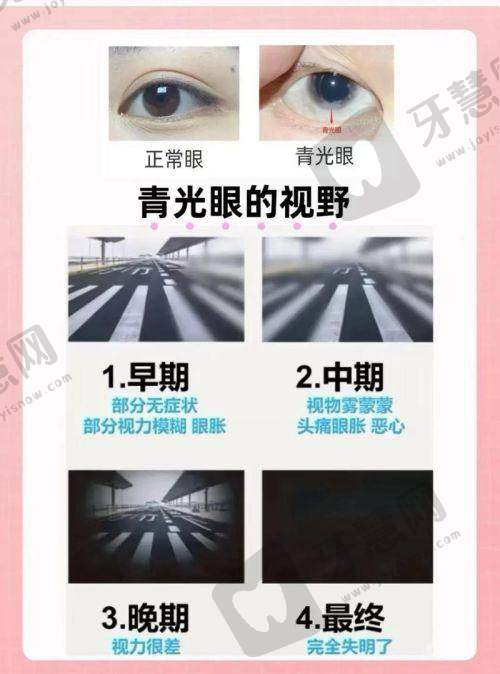 北京何氏眼科医院预约和询问方式