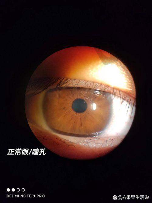 大连普兰店爱尔眼科医院未来发展如何