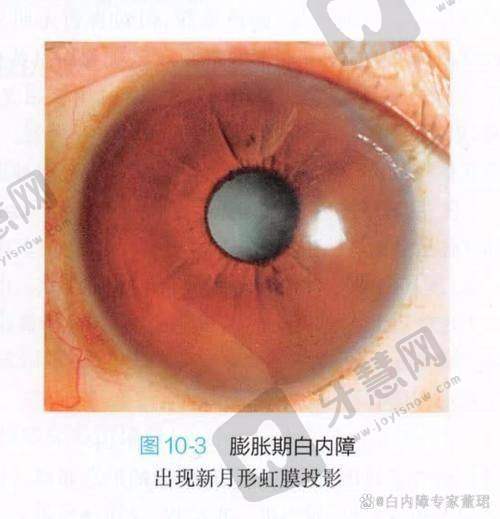 大连爱尔眼科医院是否为正规医院