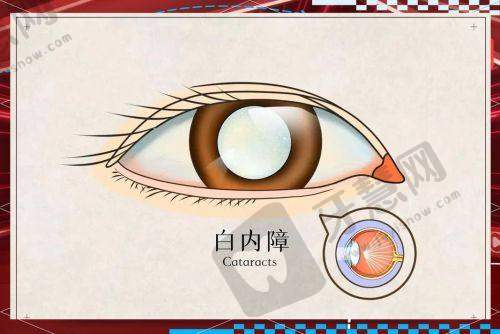 大连普兰店爱尔眼科医院上班时间是怎样安排的