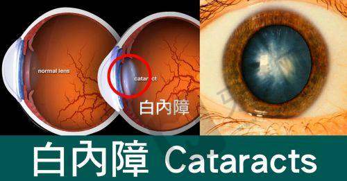 北京熙仁眼科医院特色诊疗项目