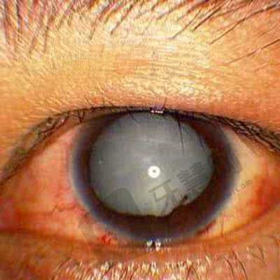 北京熙仁眼科医院价格指南