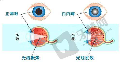 北京熙仁眼科医院患者口碑
