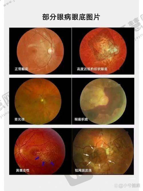北京熙仁眼科医院预约方式多样