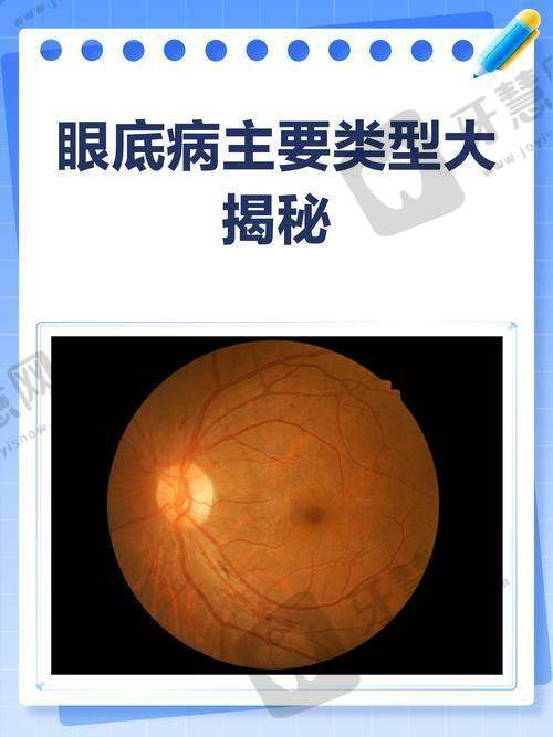 大连普兰店爱尔眼科医院骨干医生团队的实力