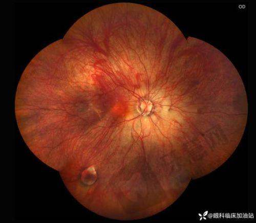 北京熙仁眼科医院的地理位置与交通便利程度
