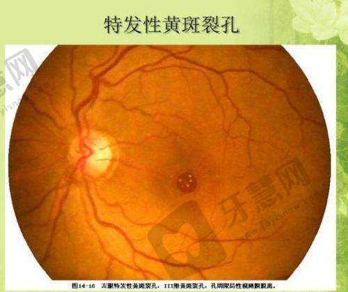 北京未来儿童医院眼科患者评价和口碑怎么样
