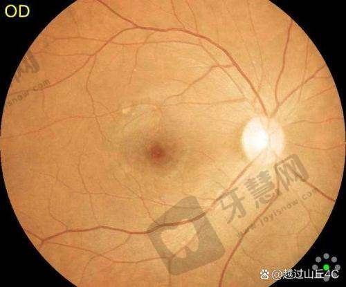 北京熙仁眼科医院的优势总结