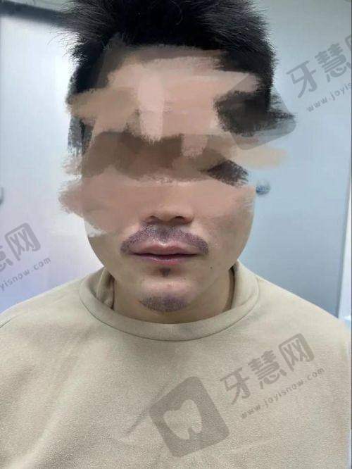 哈尔滨即美整形门诊部价格表